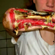 Illustration for article titled emKrokodil/em: Russias Designer Drug That Will Eat Your Flesh